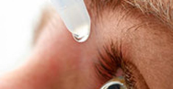 Get Rid of Red Eyes – Cures, Remedies, Redness in Eyes Treatment - Artificial Tears (2)