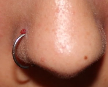 Infected Nose Piercing –How to Treat & Clean Nose Piercing Infection